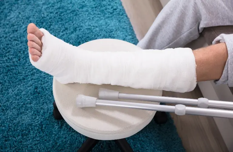 Person's leg in a white cast resting on a stool beside a pair of silver crutches.