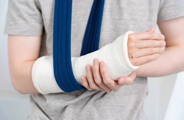 Person wearing a gray shirt with a white arm cast supported by a blue sling.
